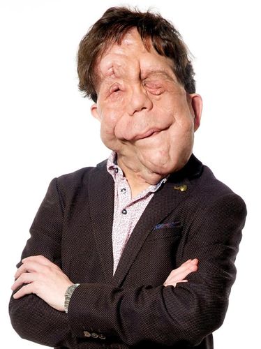Adam Pearson - 
