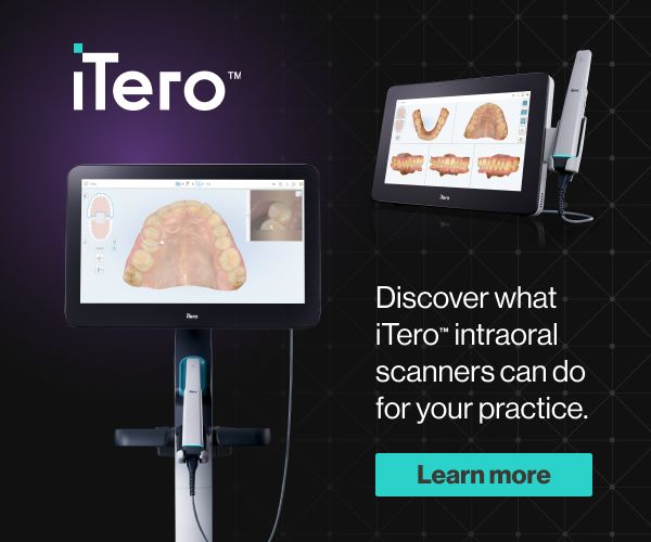 iTero-scanner