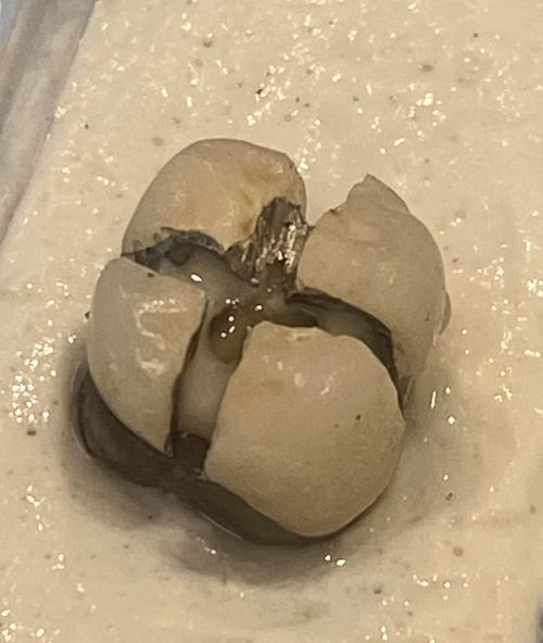 PFM Crown Cutter