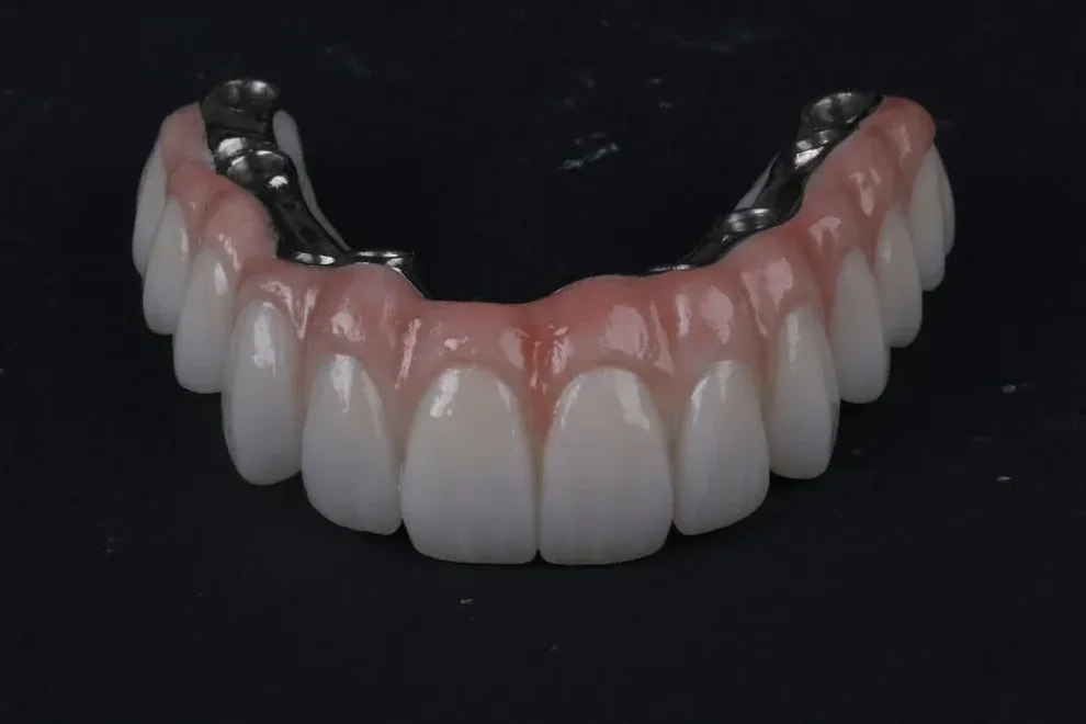 Exodent Digital Lab Brings Precision Implant Excellence to Dental Showcase London 2026