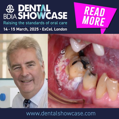 The Fight Against Mouth Cancer Continues at BDIA Dental Showcase 2025