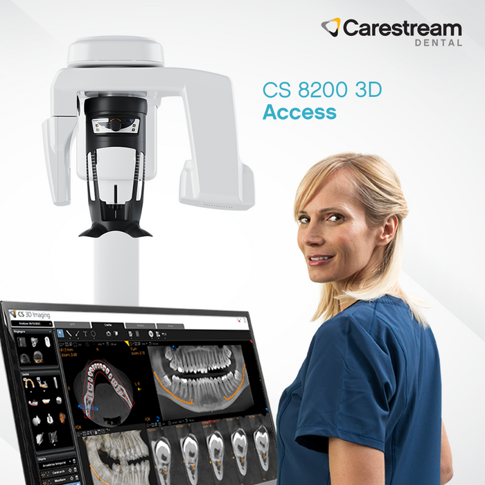 CS 8200 3D Access