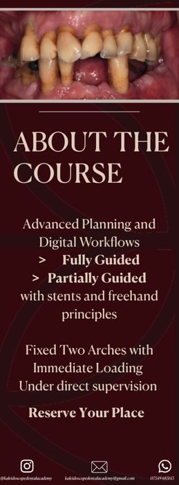 Full-Arch All-on-X Intensive