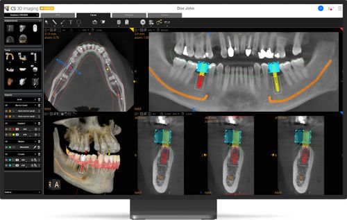 CS 3D Premium