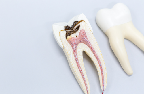 MSc Endodontics