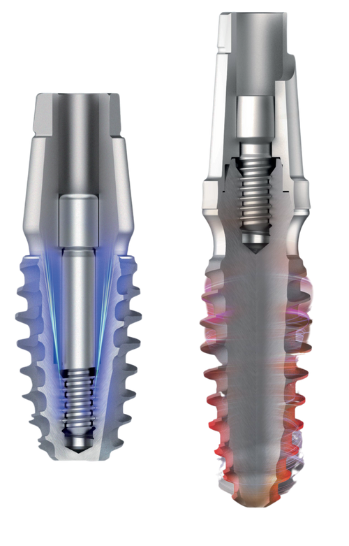 bright implant (Tissue & Bone Level)