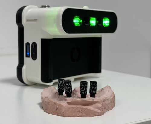 Tupel 3D Implant Scanner