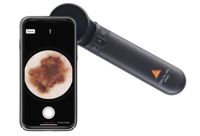 HEINE DELTA 30 PRO dermatoscope