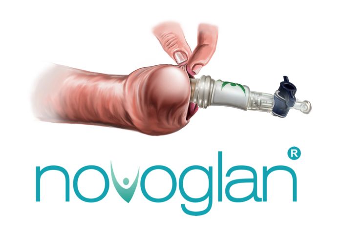 Novoglan Foreskin Expander