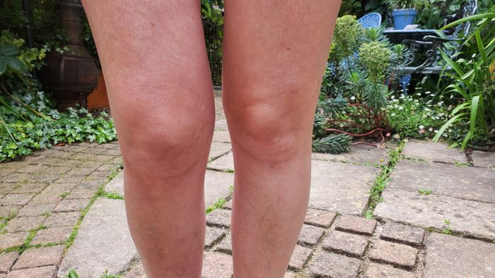 The STAK Knee Stretcher