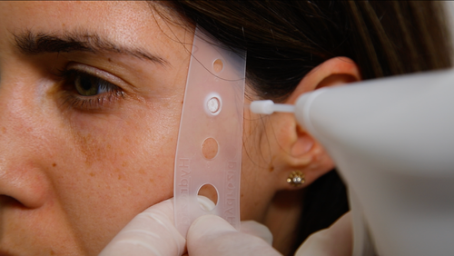 Hydrozid for cryosurgery