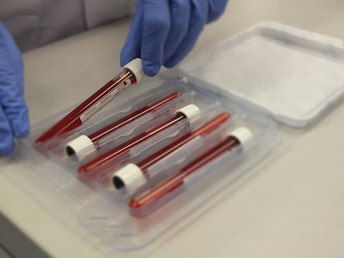 SpeciSafe® Streamlines Patient Sample Transport