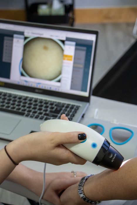 DermoSight Teledermoscopy Solution