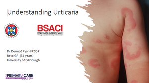 Understanding Urticaria