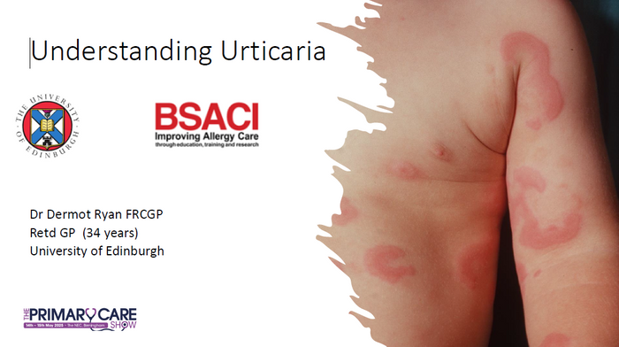 Understanding Urticaria