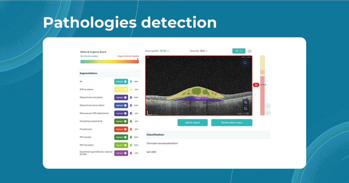 AI for OCT analysis: 70+ biomarkers/pathologies detected