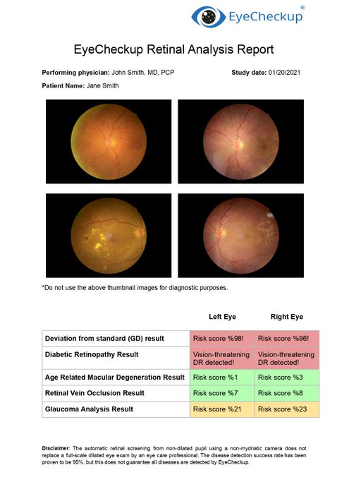 EyeCheckup