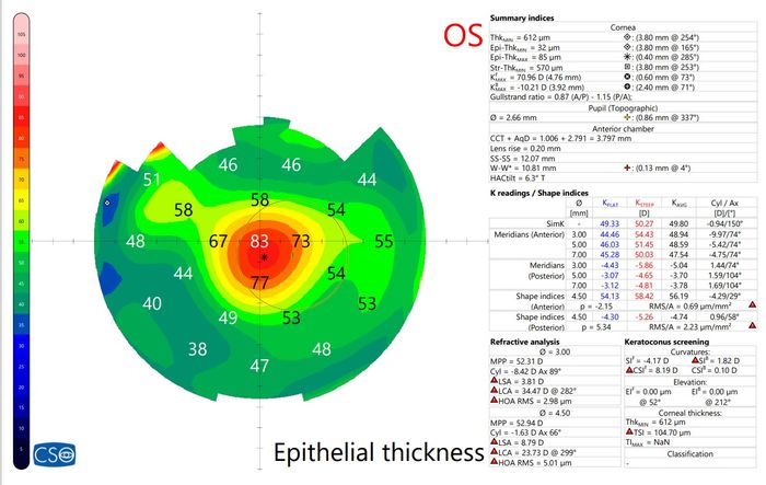 CSO MS-39 Anterior Segment OCT