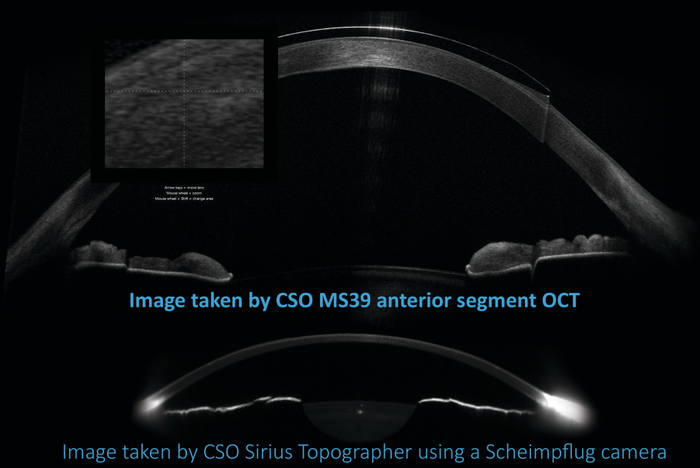 CSO MS-39 Anterior Segment OCT