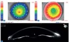 CSO Sirius+ Topographer