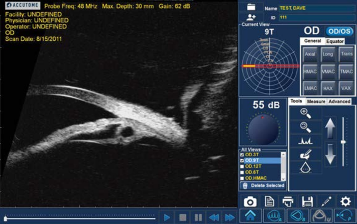 Accutome 4Sight - 4 in 1 Ultrasound Combi Unit, A Scan, B Scan, UBM & Pachymeter