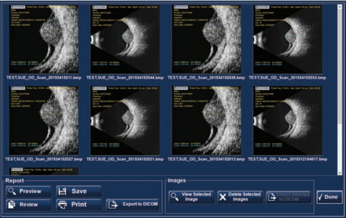 Accutome B-Scan Plus