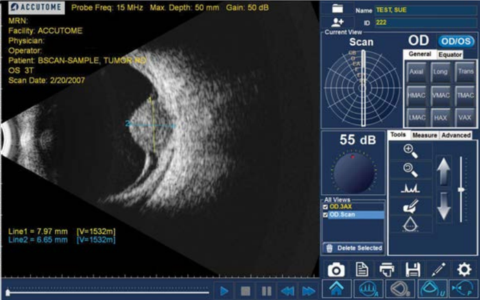 Accutome B-Scan Plus