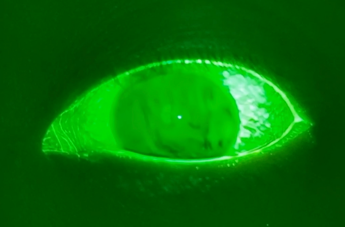 New Fluorescein Filter from Aston Vision Sciences