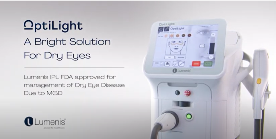 OptiLight by Lumenis- A Bright Solution for Dry Eyes