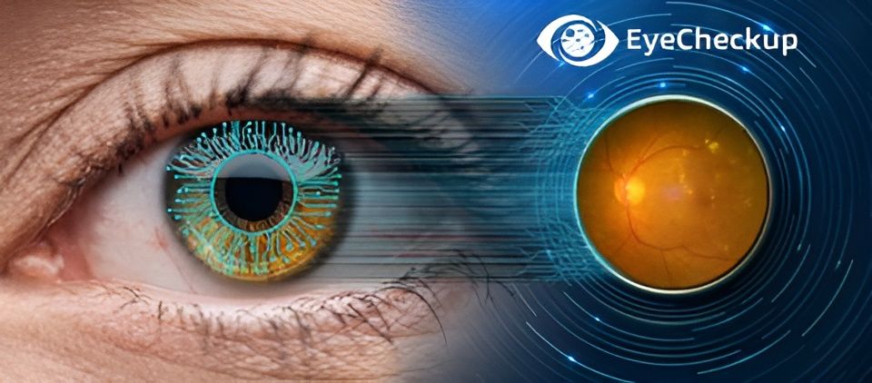 EyeCheckUp