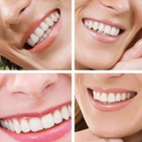 Cosmetic Teeth Whitening Products