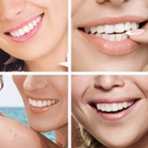 Cosmetic Teeth Whitening Products