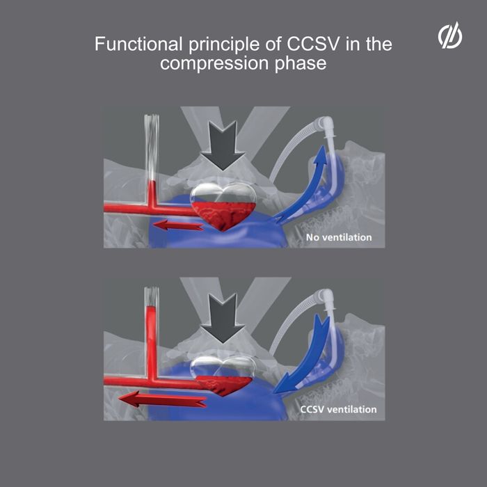 MEDUMAT Standard2 with CCSV
