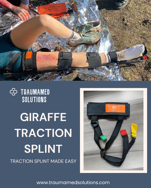 Giraffe Traction Splint