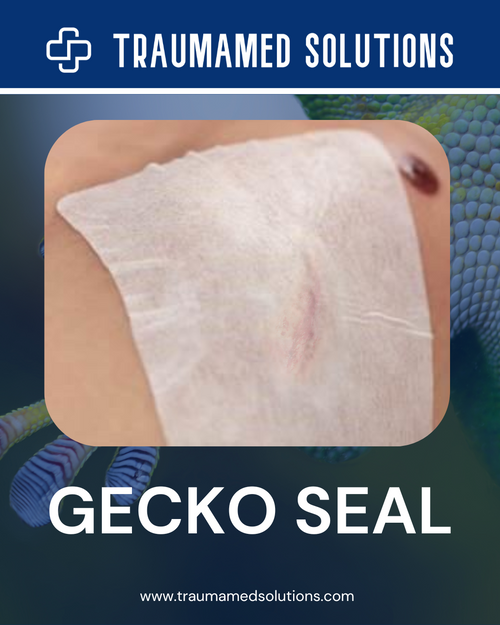 Gecko Seal