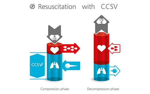 Resuscitation with CCSV - WEINMANN Medical Technology