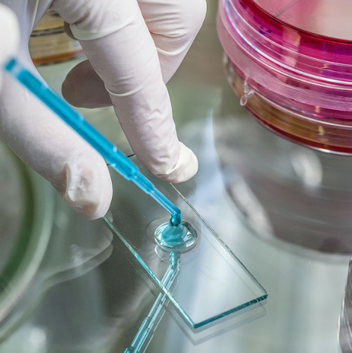 Legionella Monitoring