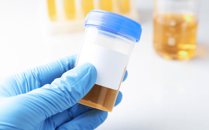Top 5 Myths About Urine Drug Tests