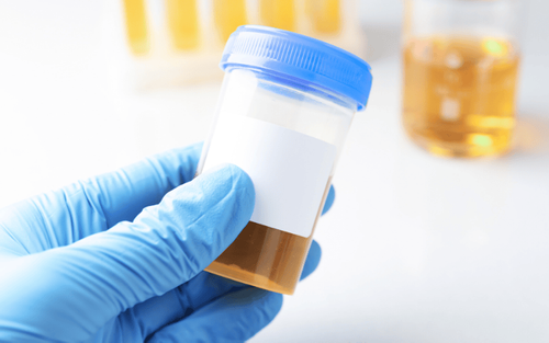 Top 5 Myths About Urine Drug Tests