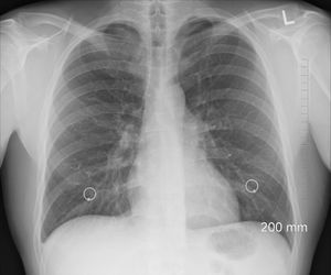 Asbestos - what is it, where does it come from, why is it harmful, how is it harmful, how can we detect it and how can it be an environmental benefit?