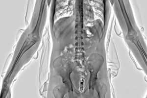 Conpass Smart Body Scanner Range