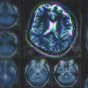 Nearly half of UK adults cannot name a single type of dementia
