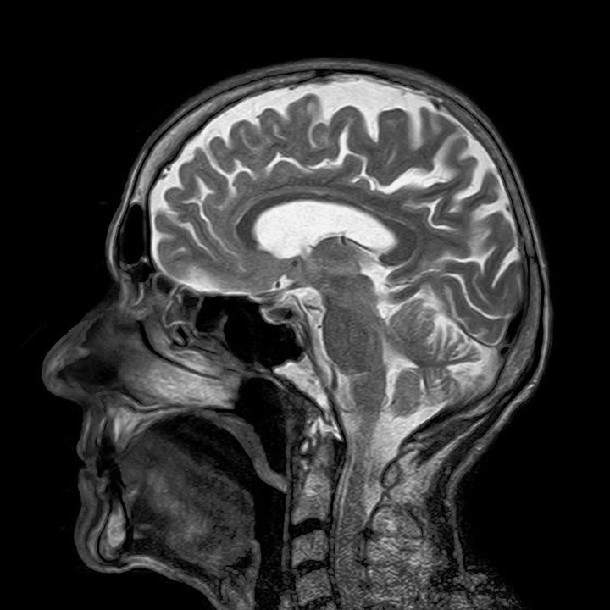 The Most Detailed MRI Scan Ever