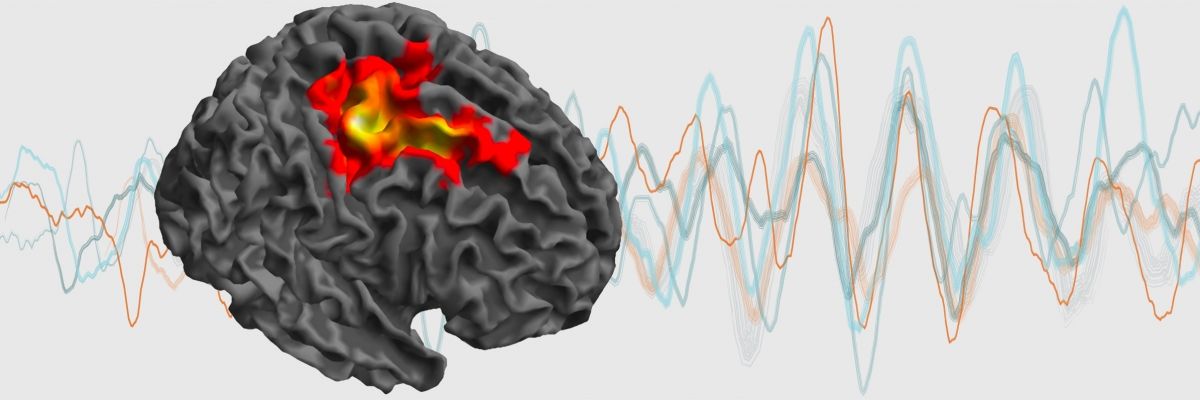 MRC Brain Network Dynamics Unit