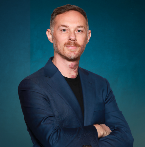 Marco Beranzoni