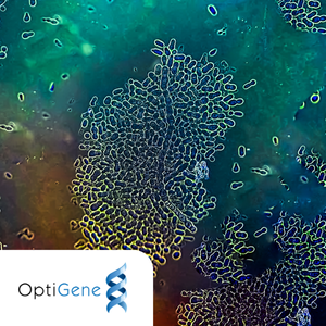 Fighting the Silent £3bn Threat to Crops